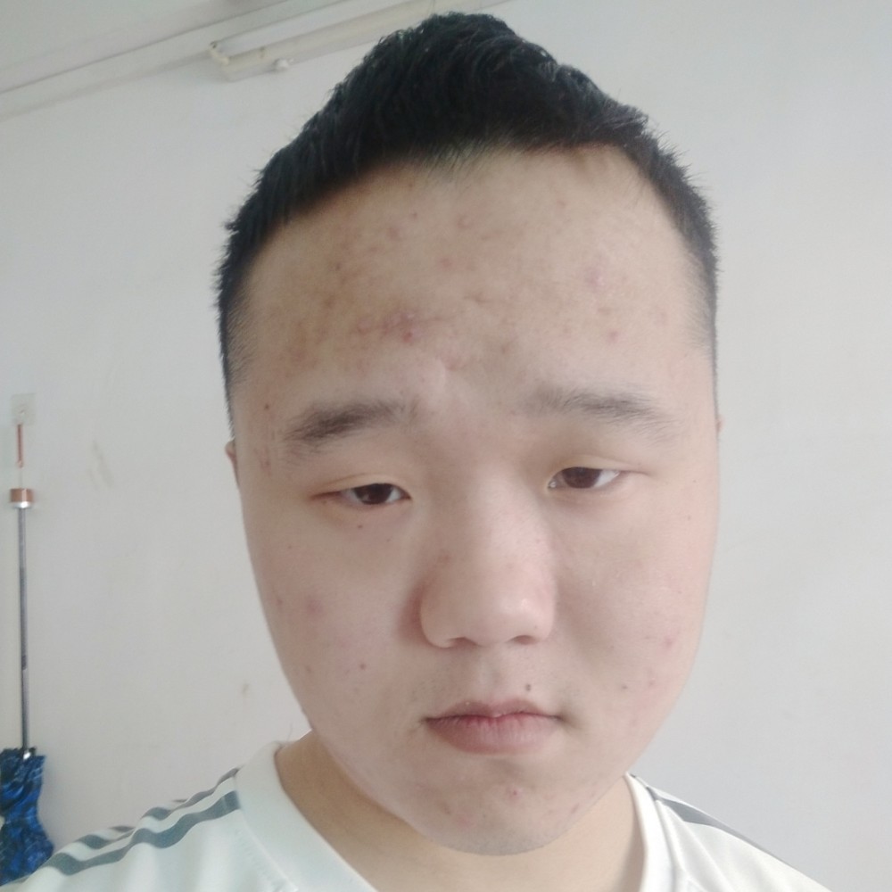 哭泣的蜜蜂的照片