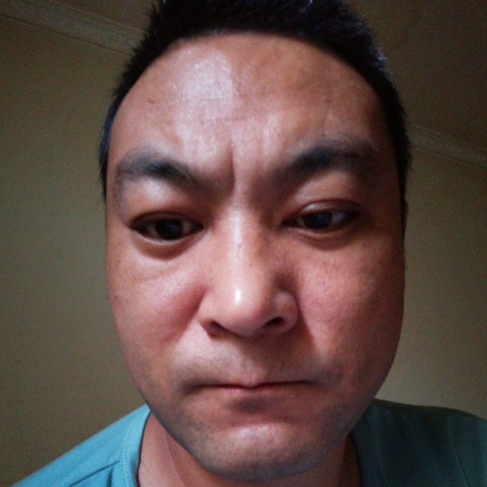胡萝卜爱受伤的照片