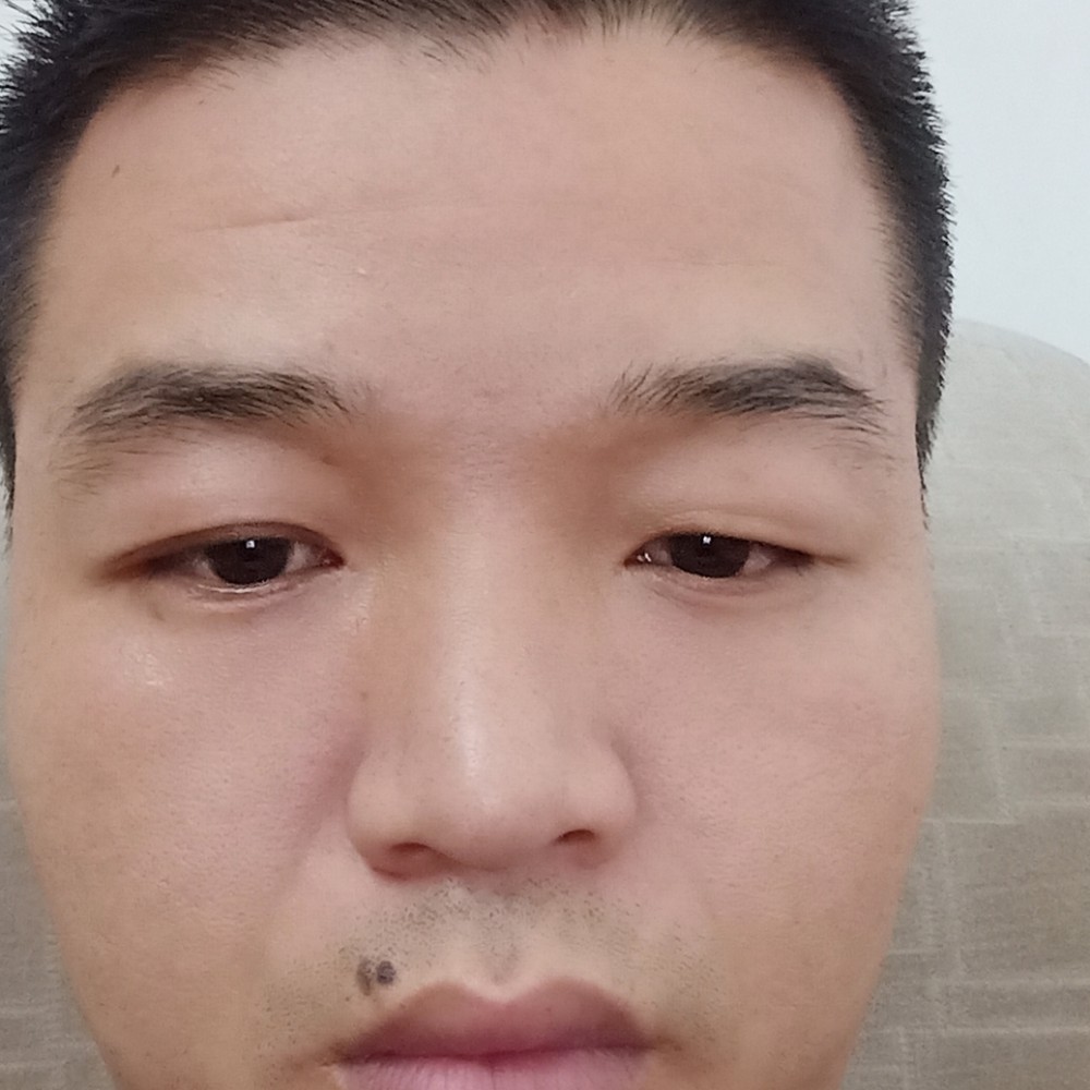 甜蜜的小刺猬的照片