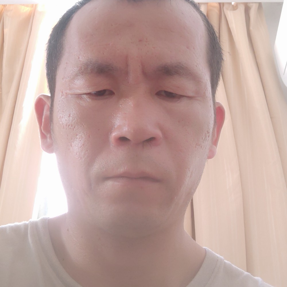 戒指闻花痴的照片