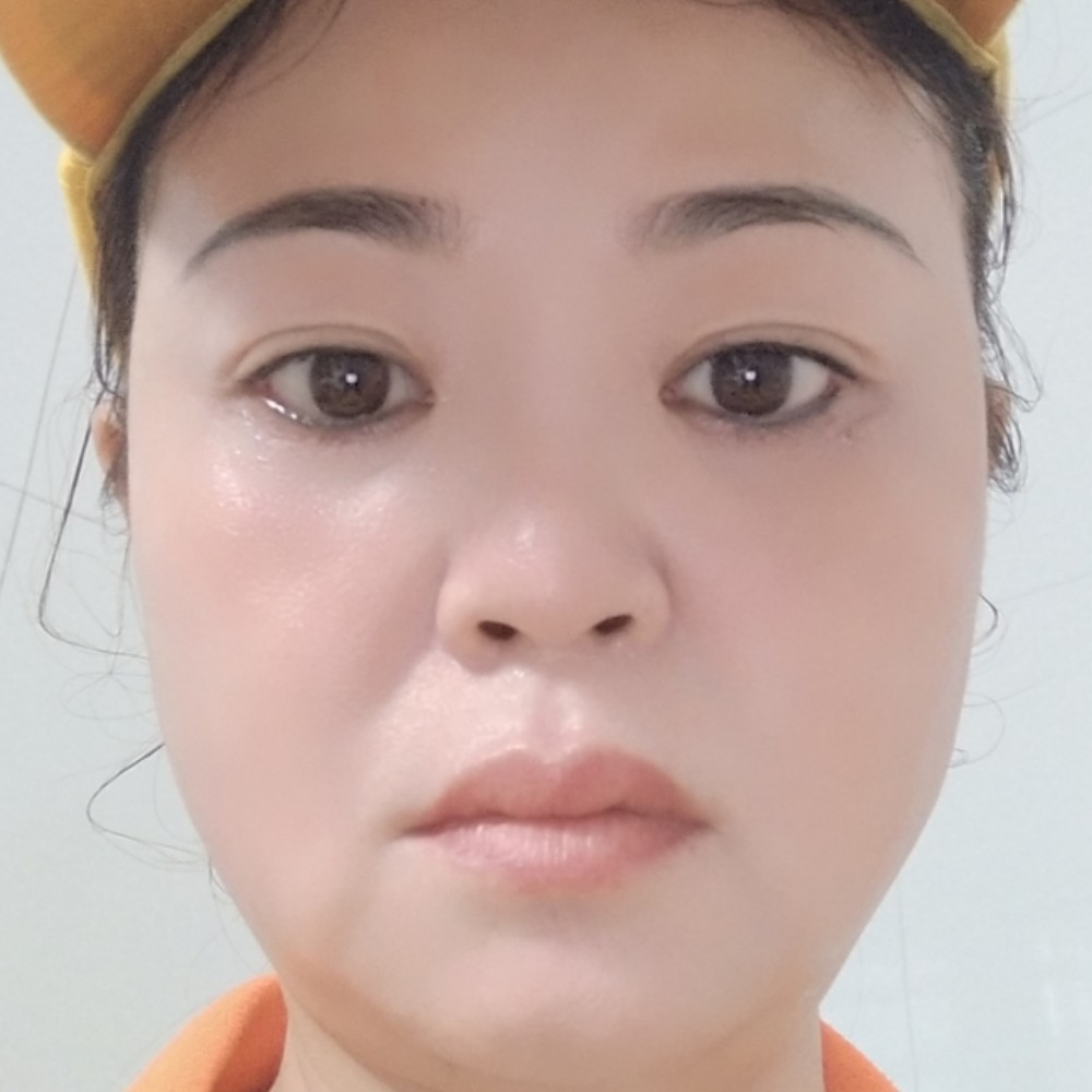 含羞草挽手香蕉的照片