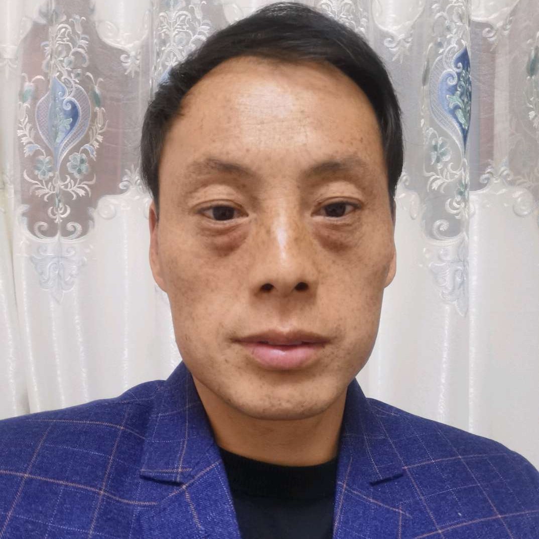 背后发卡2000的照片